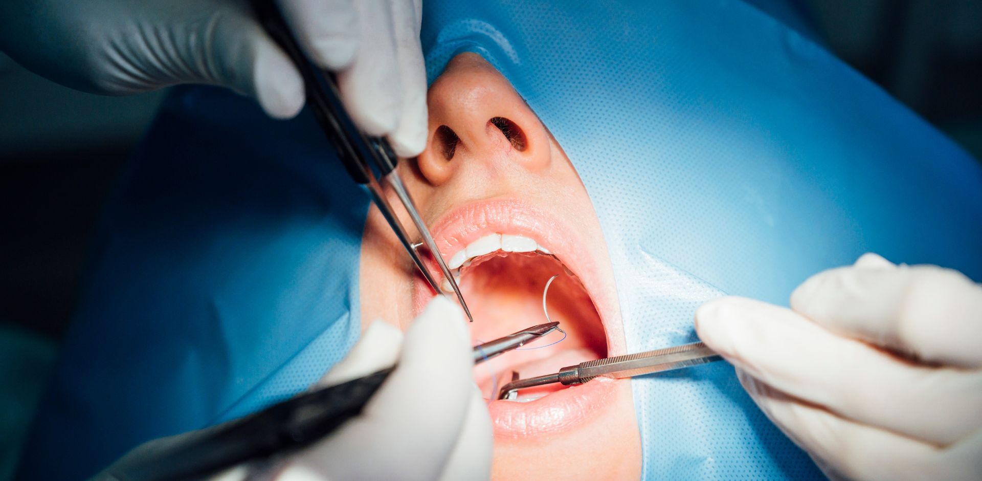 Extractions and Oral Surgery
